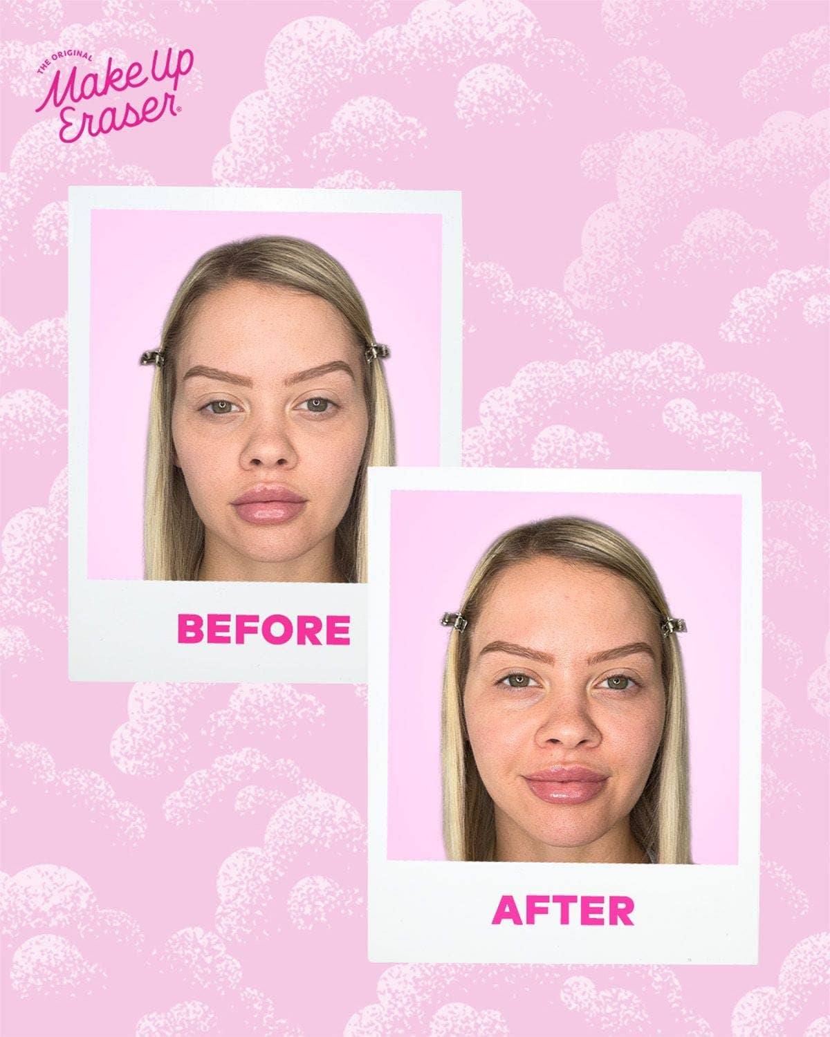 Cooling Clouds® Reusable Undereye Patches | 2024 Allure Award Winner