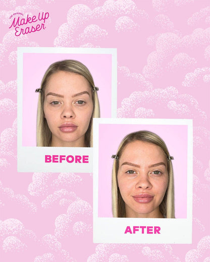 Cooling Clouds® Reusable Undereye Patches | 2024 Allure Award Winner